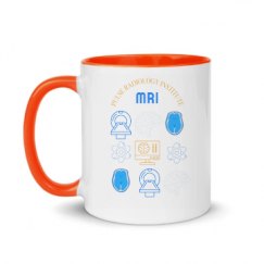 11oz Ceramic Mug with Color Inside