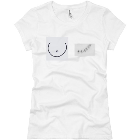 Breast cancer awareness Breast cancer awareness