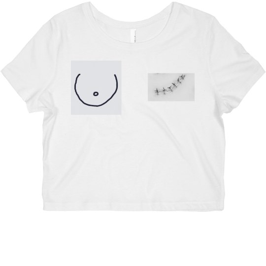 Breast cancer awareness 